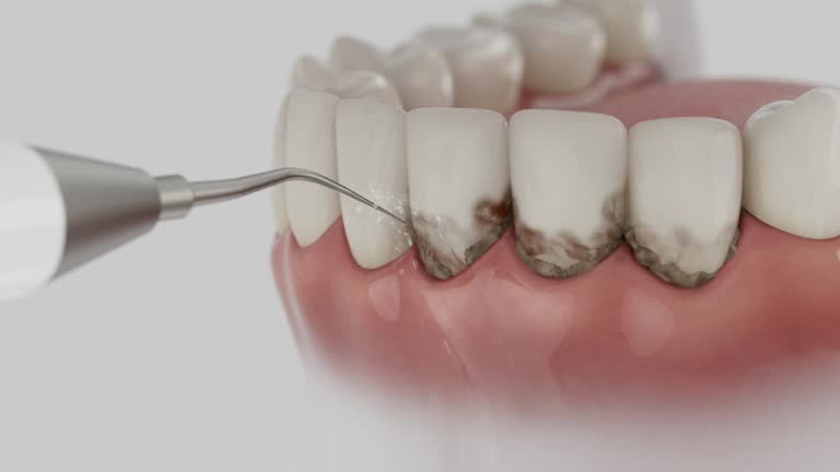 Trusted Wisdom Tooth Removal service in Tioga, ND - Dentist Open Now